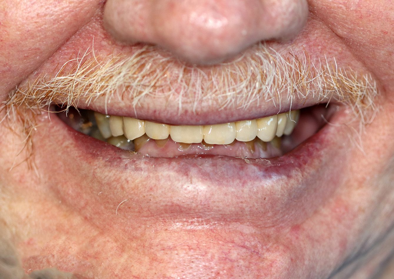 A close up of a man 's face with a mustache and teeth.