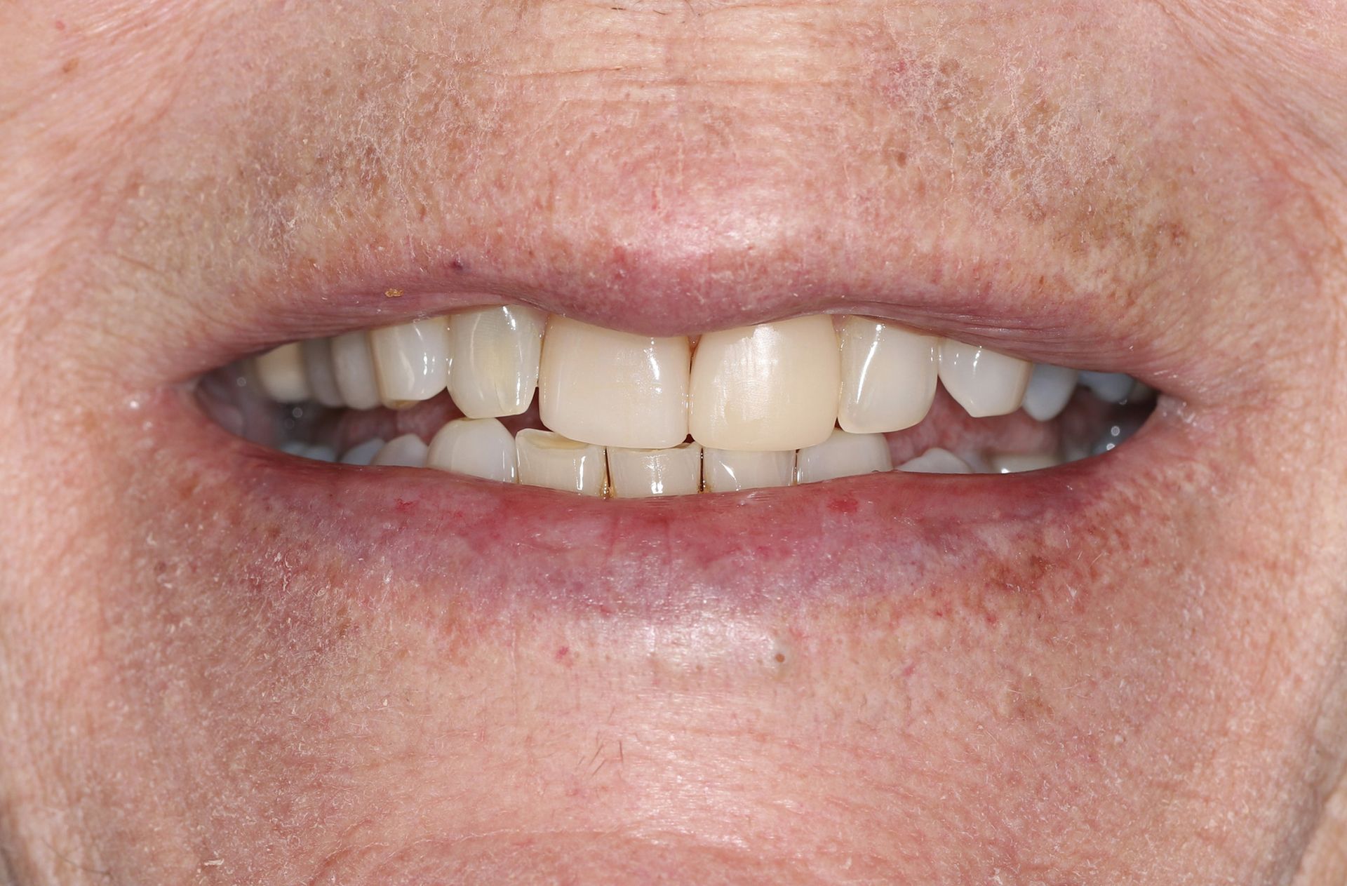 A close up of a man 's mouth with white teeth.