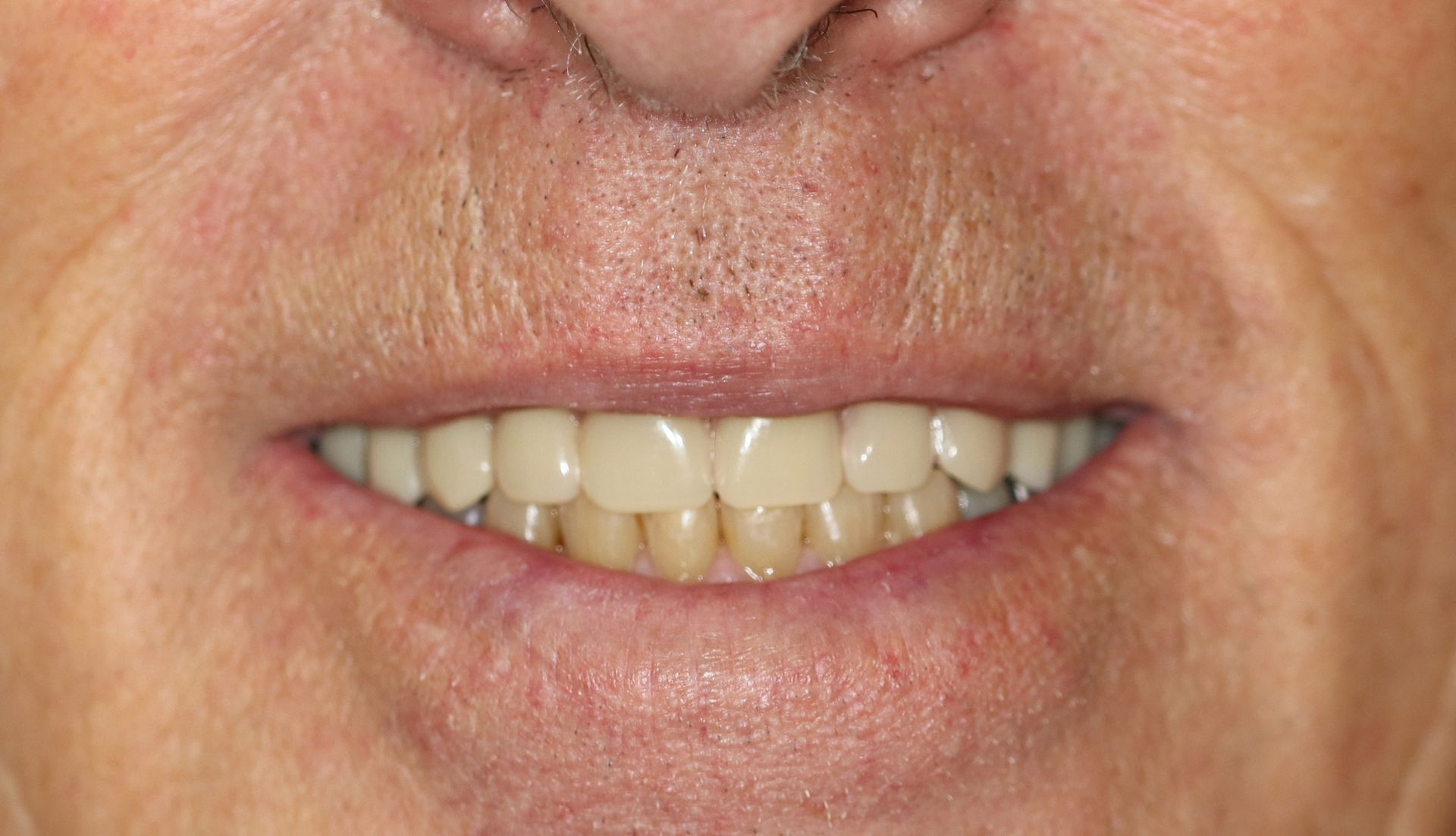 A close up of a man 's mouth with white teeth.