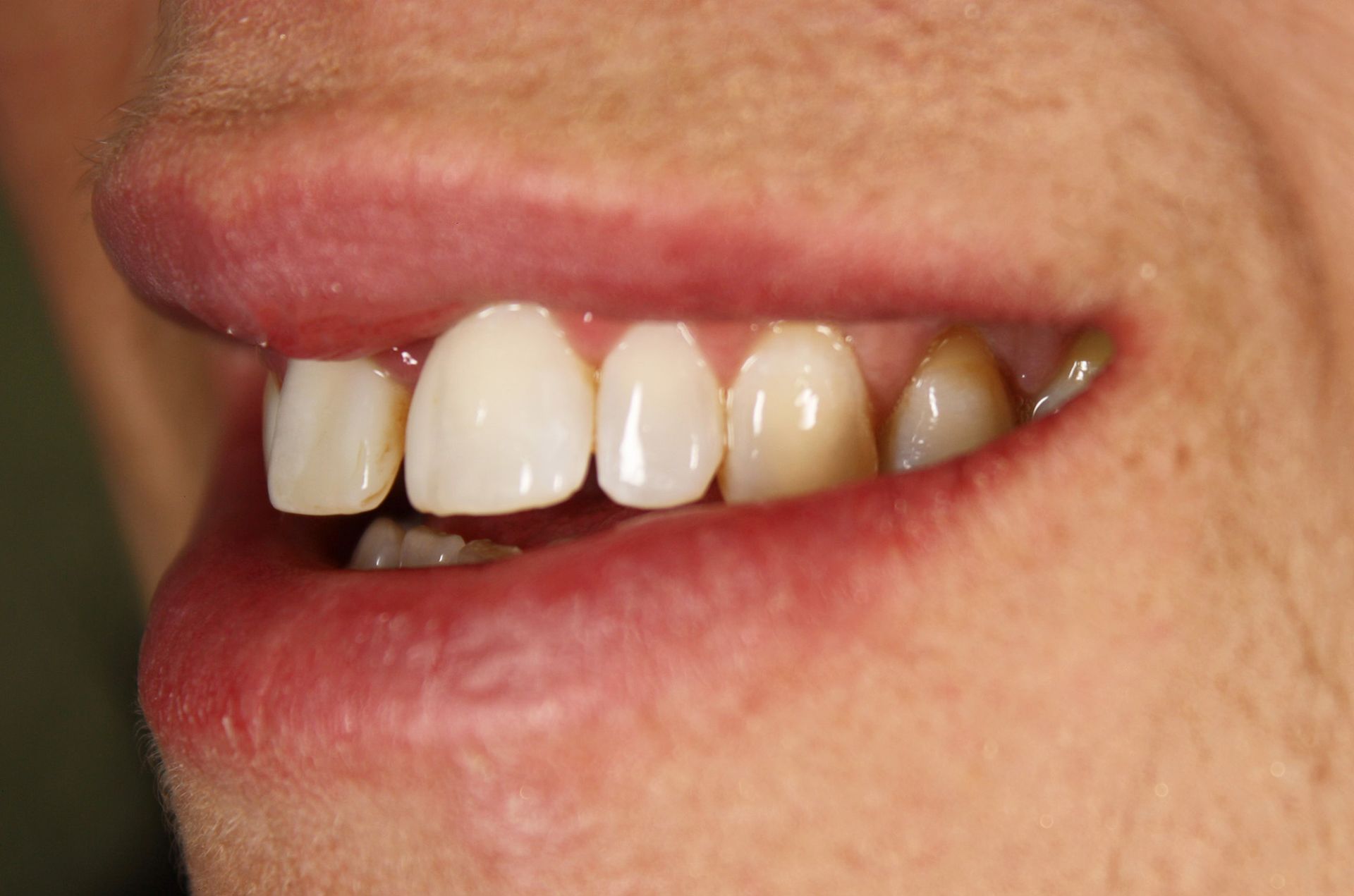 A close up of a man 's mouth with white teeth and red lips.
