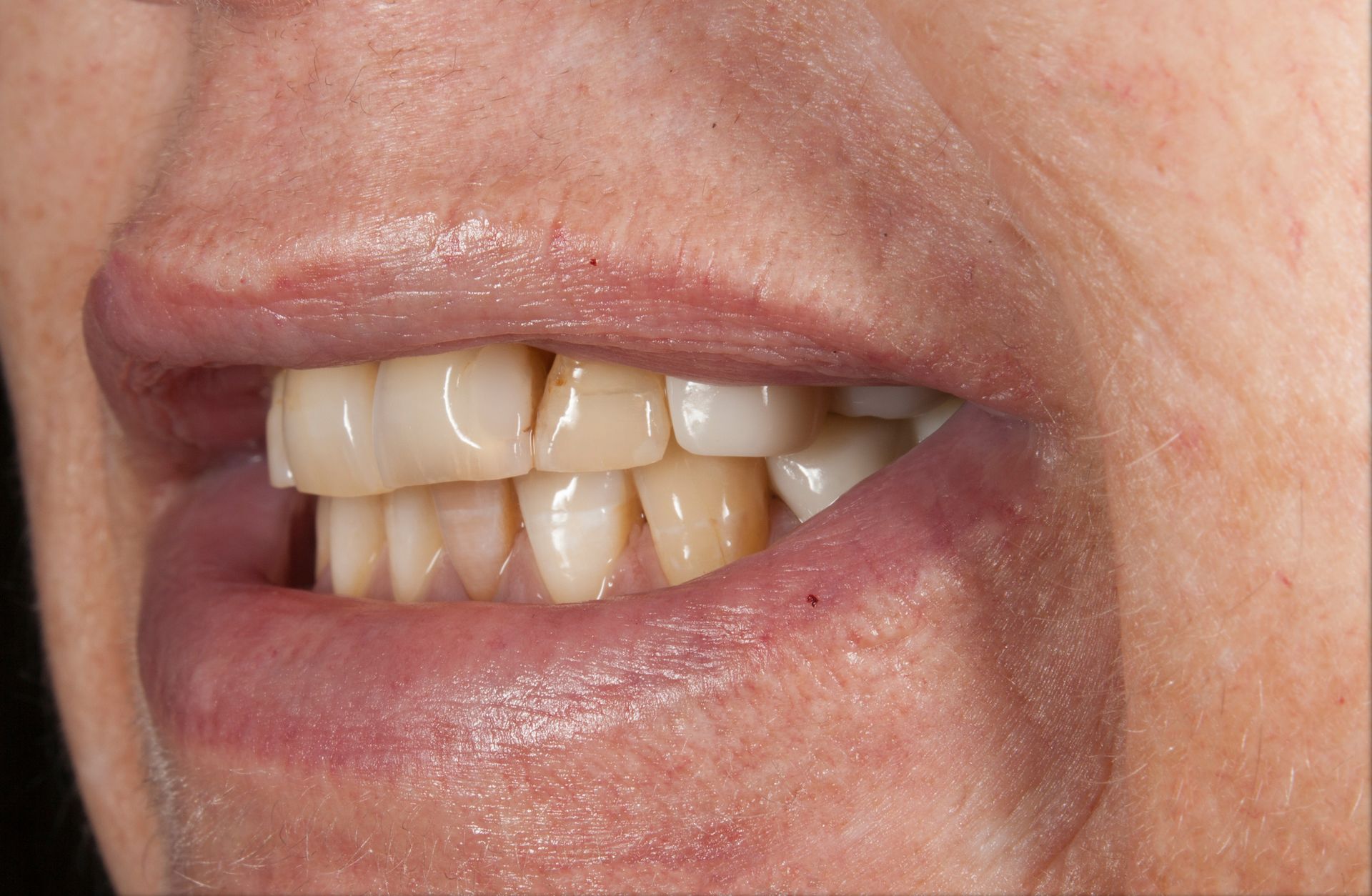 A close up of a person 's mouth with their teeth showing.