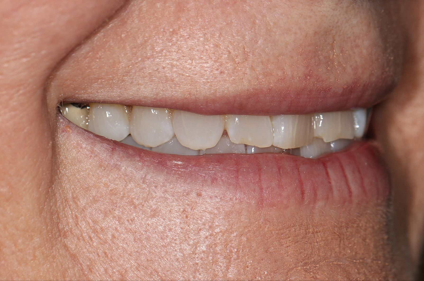 A close up of a woman 's mouth with a smile on her face.