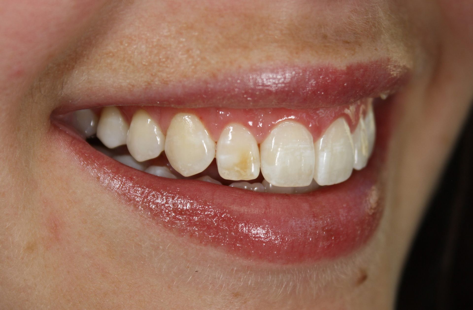 A close up of a woman 's mouth with white teeth and red lips.