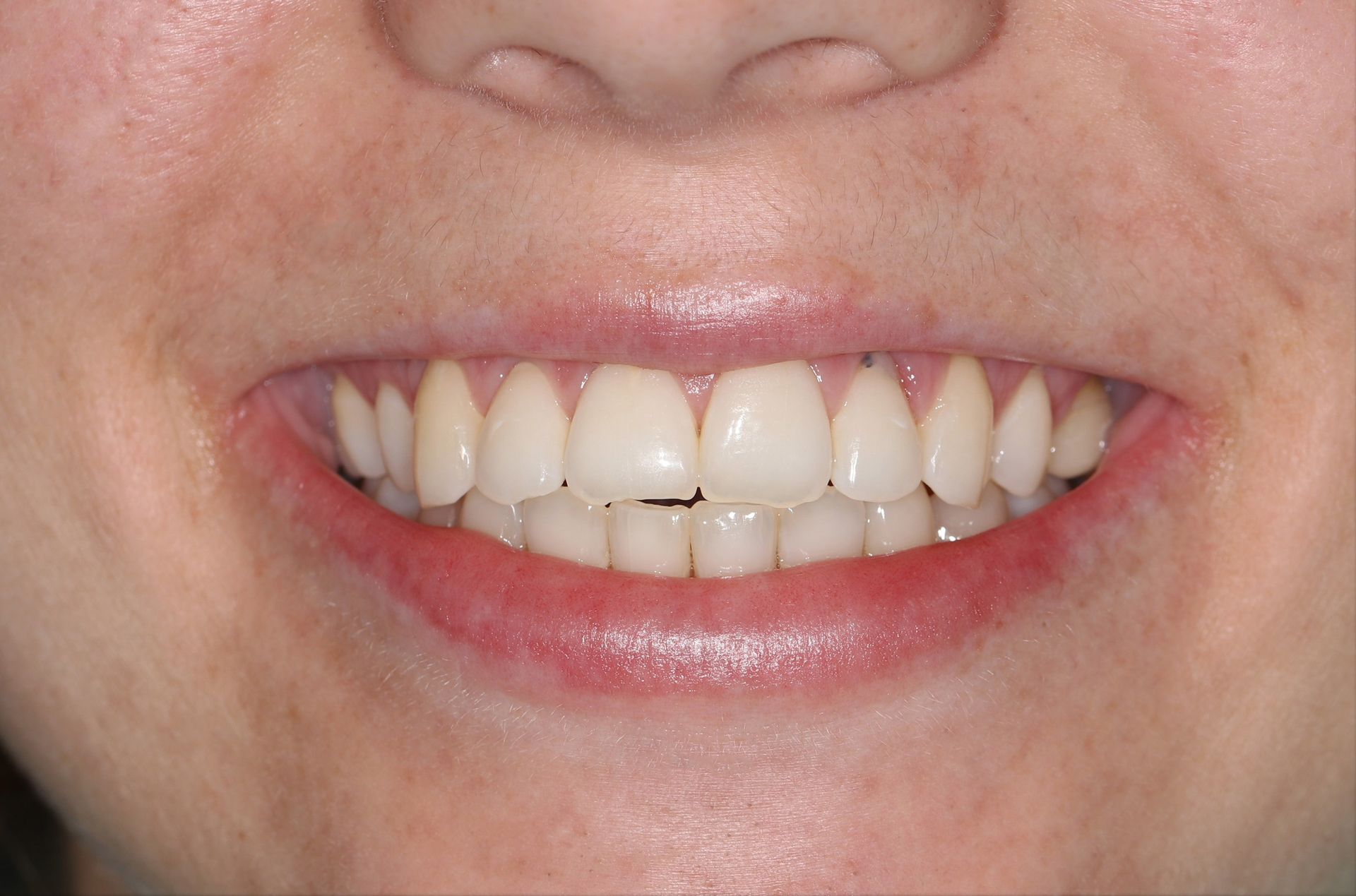 A close up of a woman 's smile with white teeth and red lips.