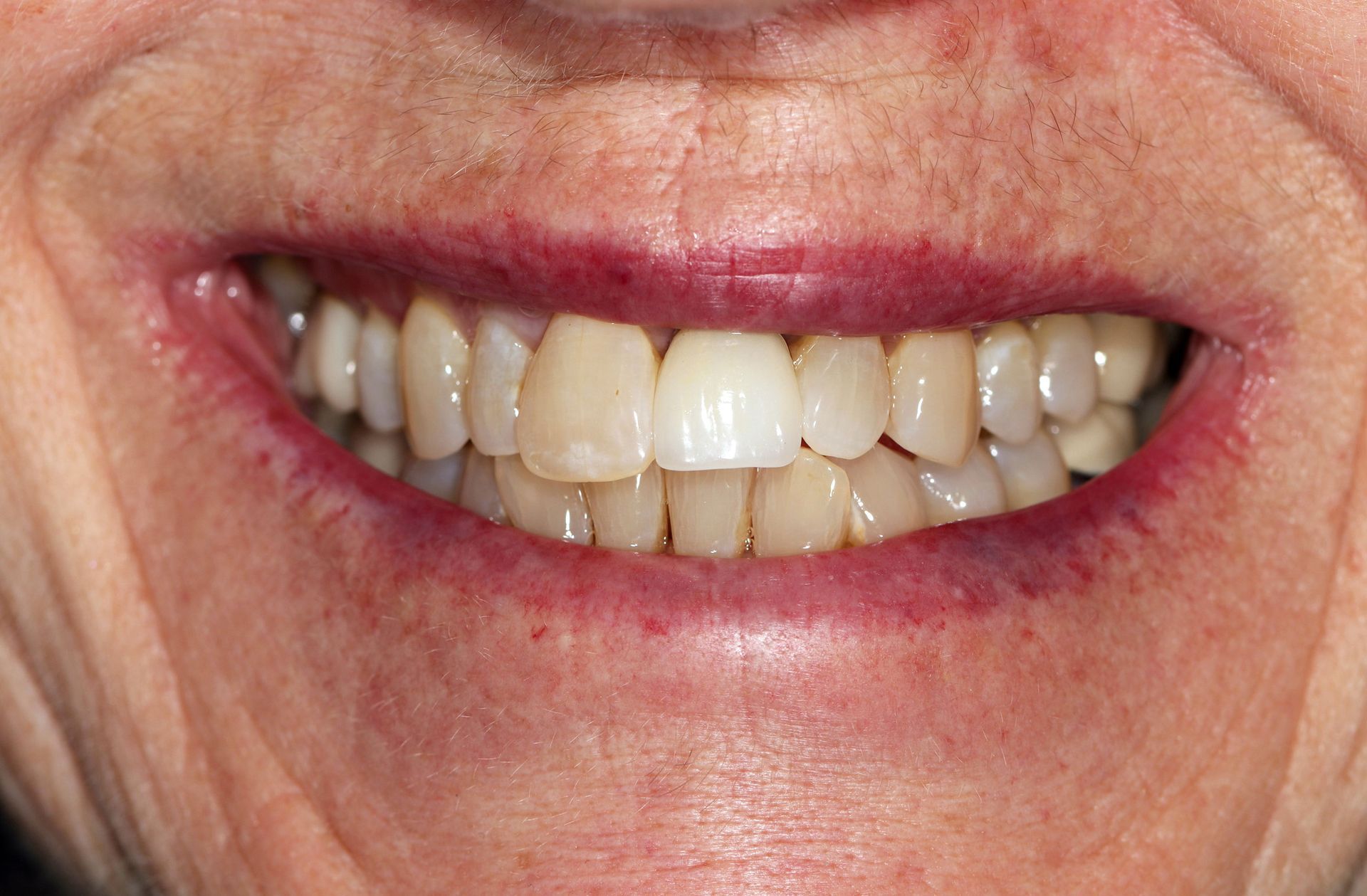 A close up of a woman 's smile with white teeth and red lips.