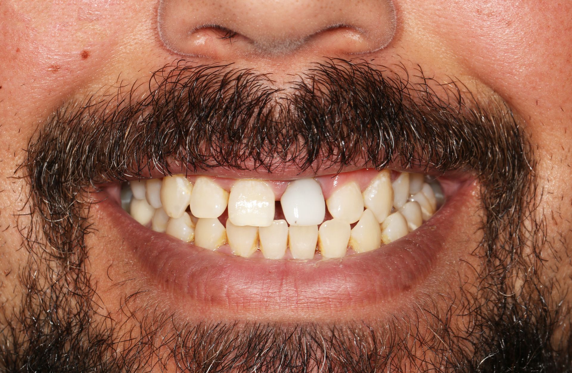 A man with a beard and white teeth is smiling.