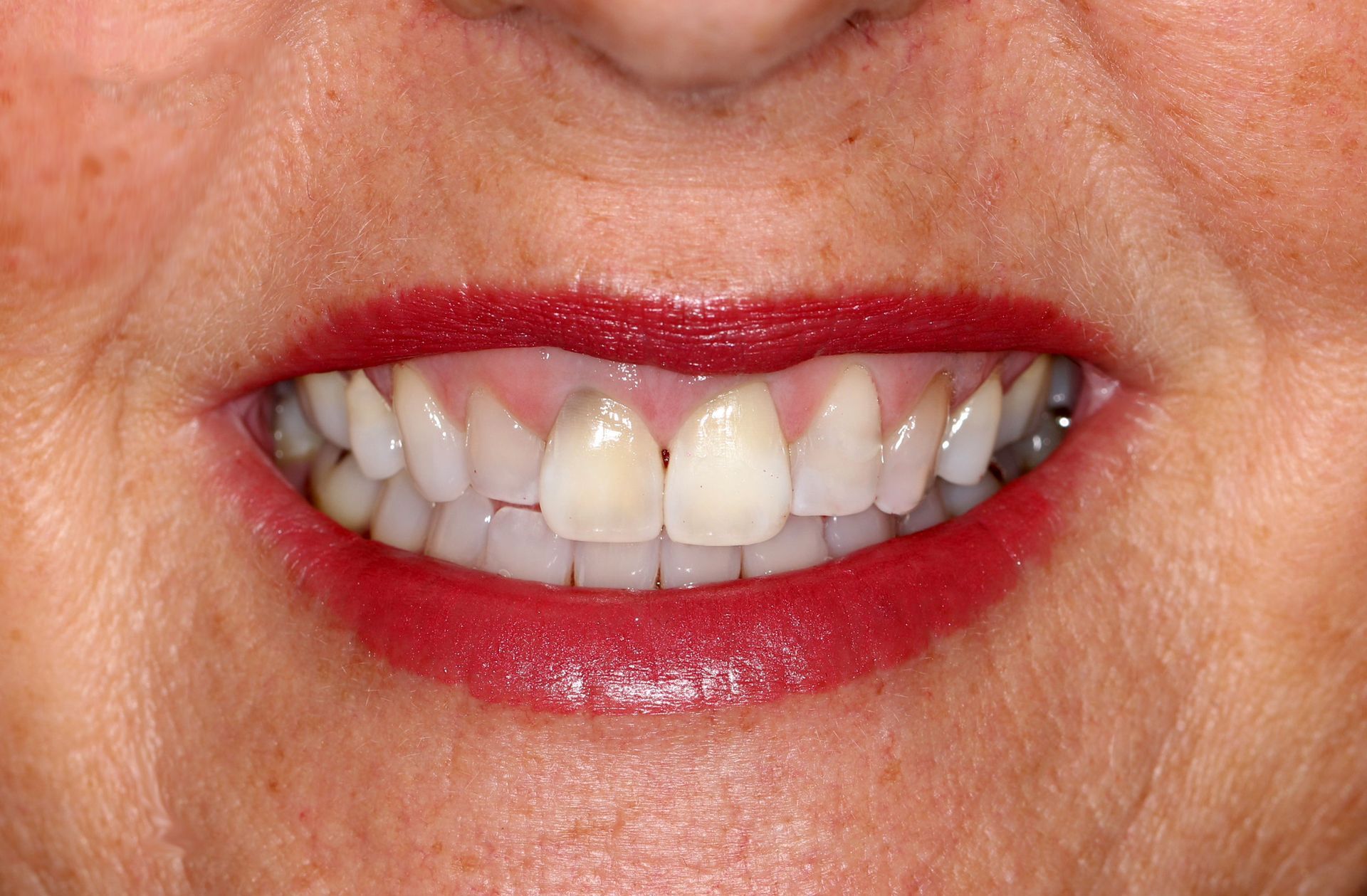 A close up of a woman 's smile with red lipstick and white teeth.