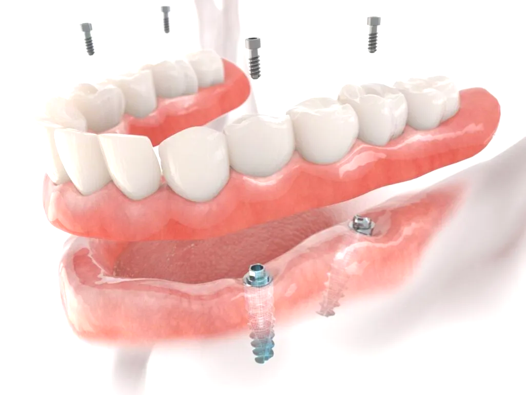 Dentist pointing at a teeth model, with dental X-rays and tools in a clinic setting.