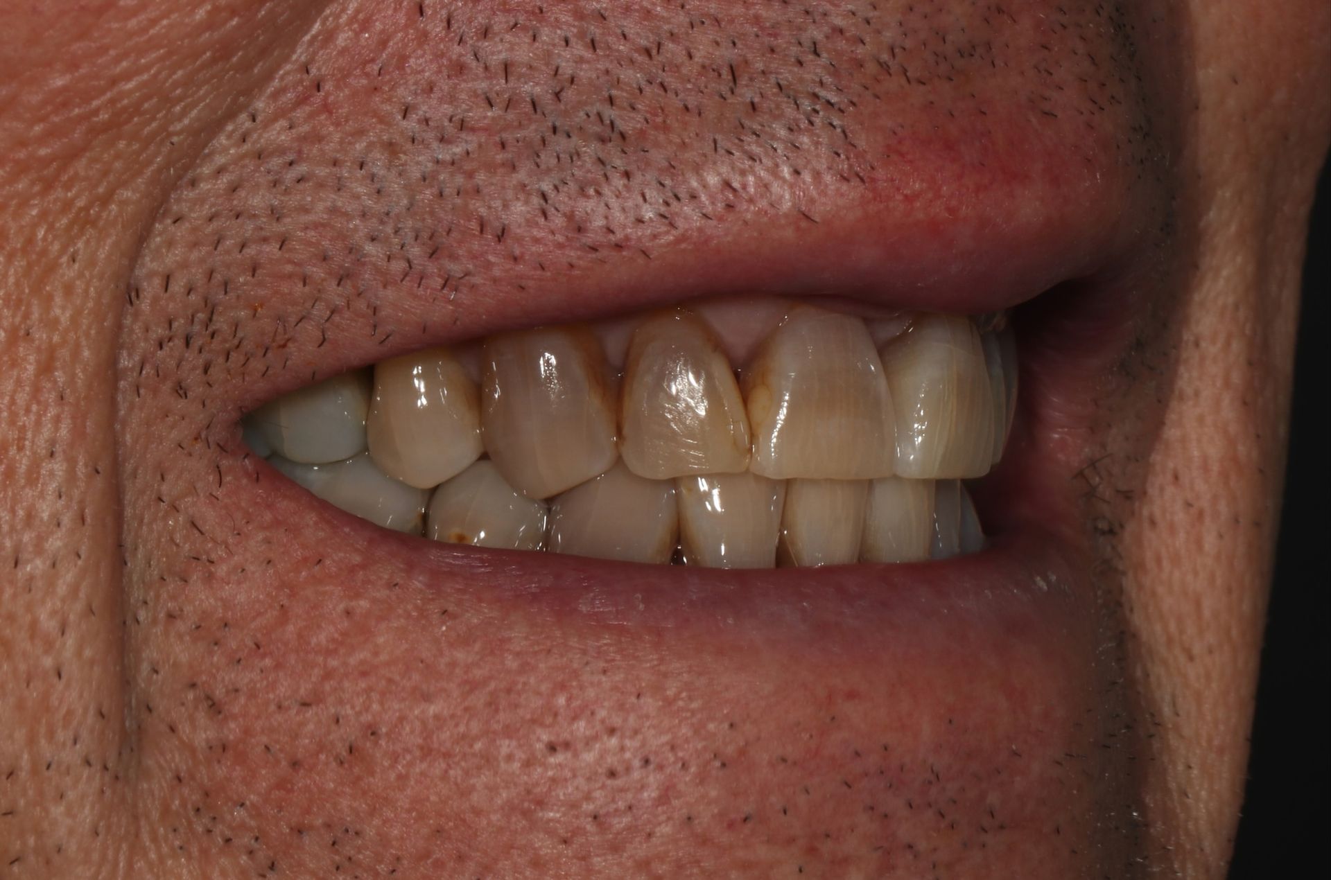 A close up of a man 's teeth with a beard.