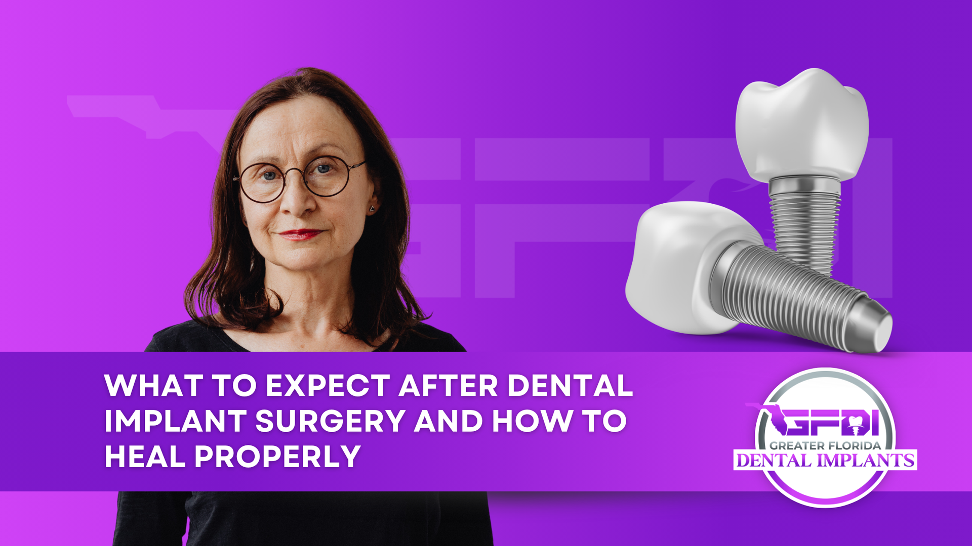 Woman with glasses next to dental implant model. Purple background, text: 