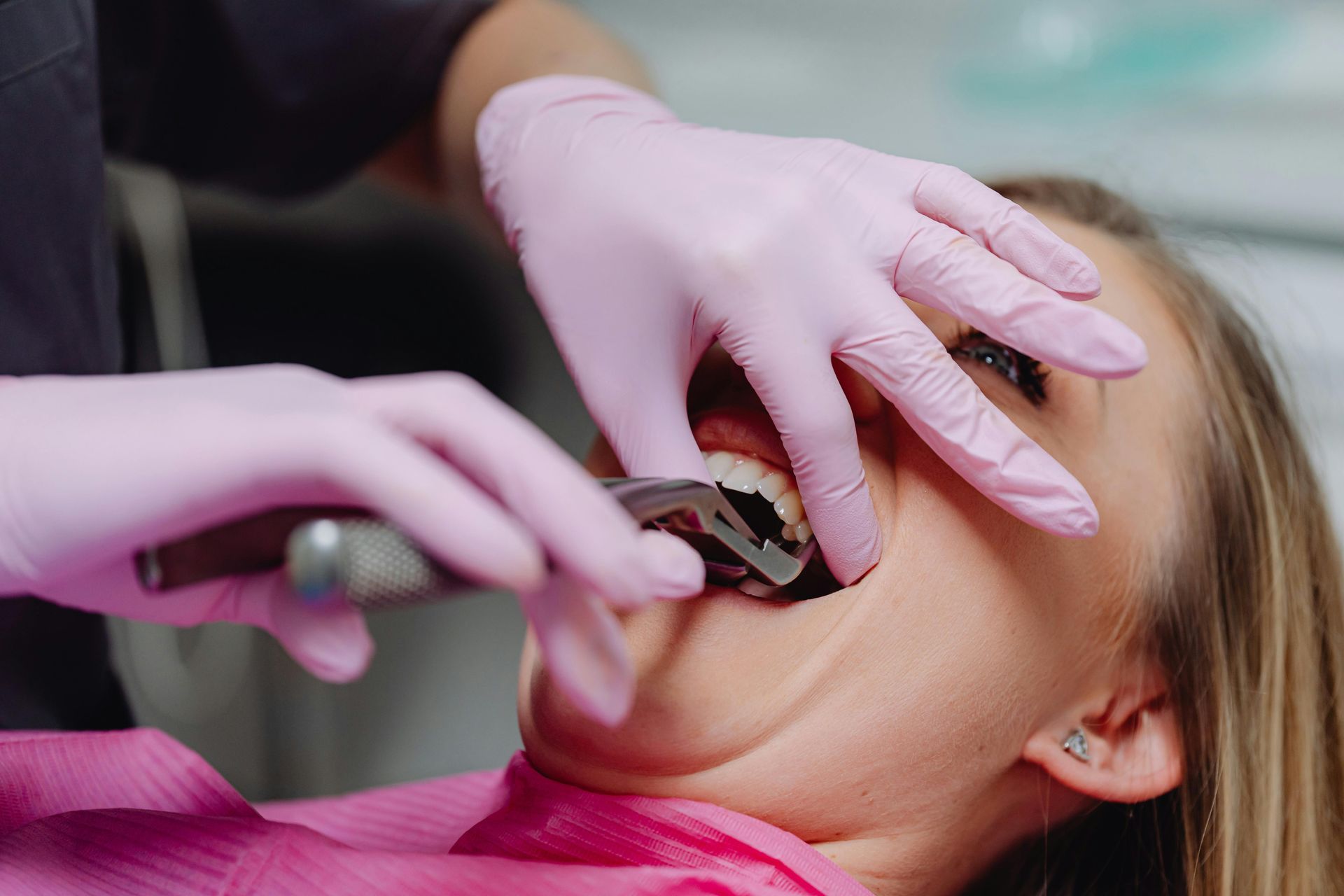 Dentist extracting a tooth from a patient's mouth with pink gloves, medical setting.