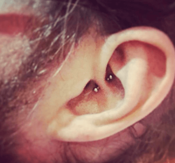 ear piercing