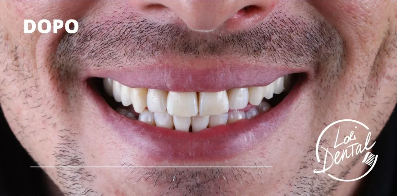 denti dritti e bianchi, con la parola