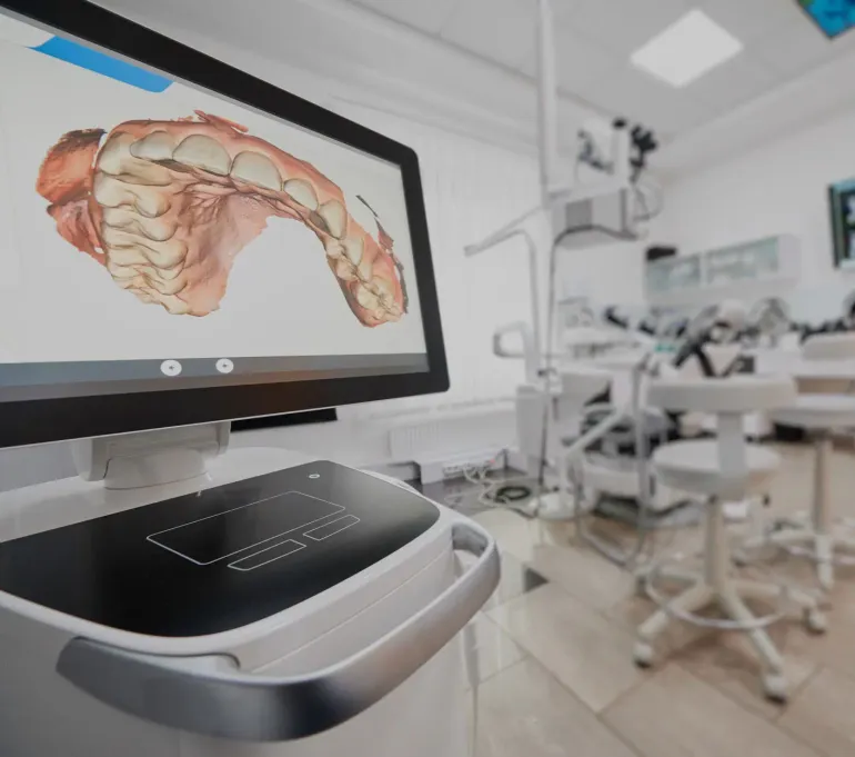 Implantologia dentale - Procedura di impianto