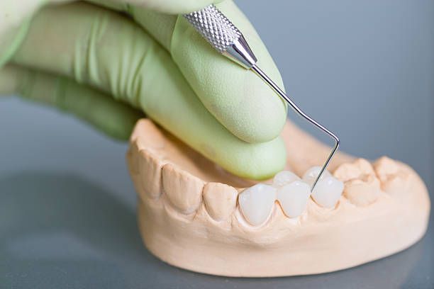 Gloved hand using a dental tool on a model of teeth and gums.