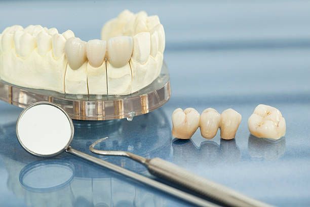 Dental crowns and bridge on a blue surface with a dental mirror and model teeth showing gaps.