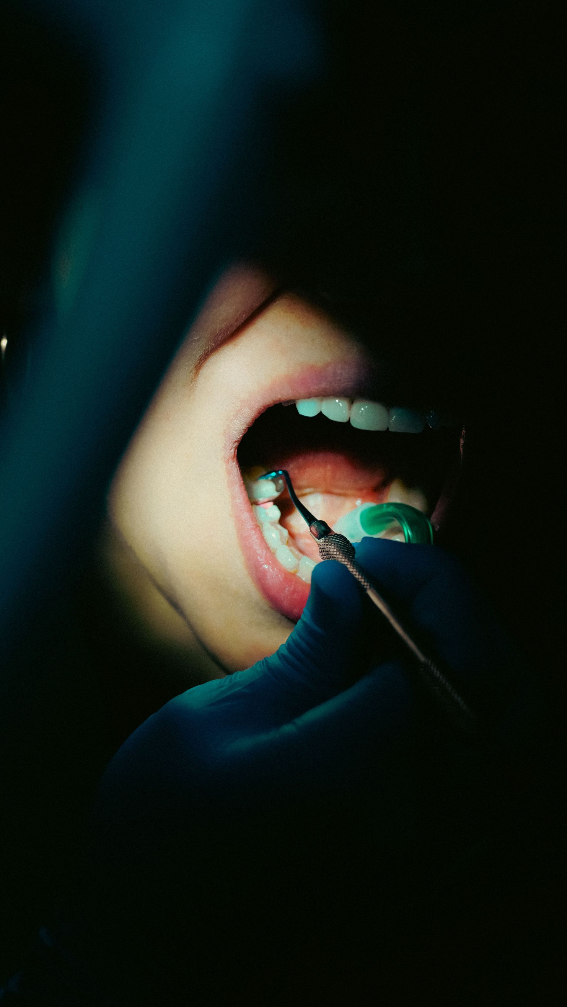 Close-up of open mouth with tongue depressor and dental mirror during a dental exam.