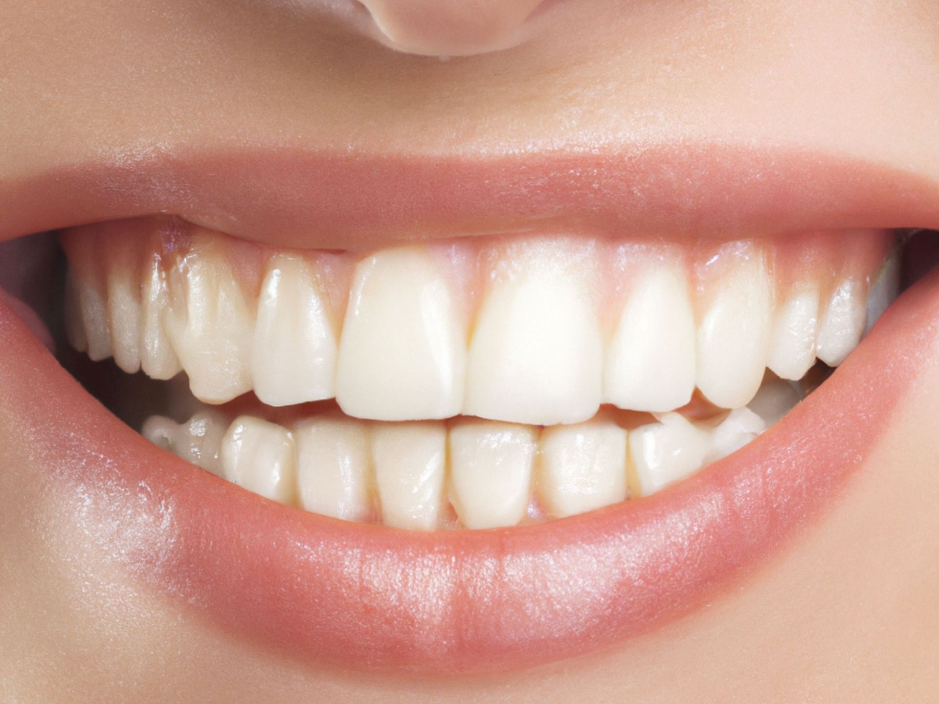 Close-up of a smiling mouth with bright white teeth.