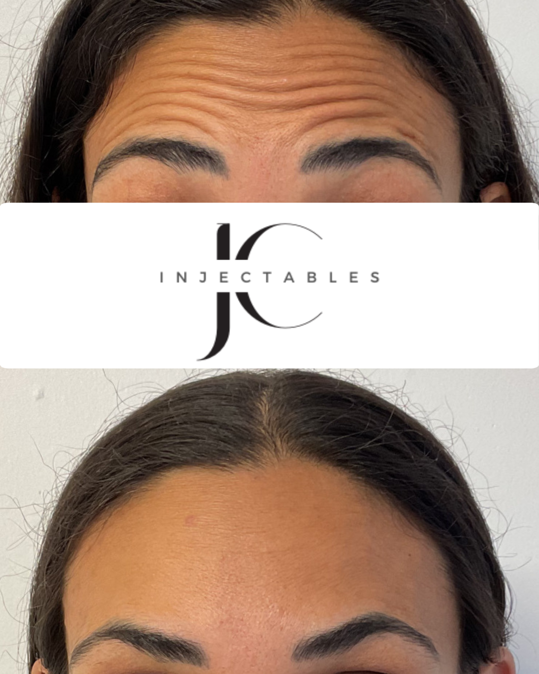 JC Injectables before and after image