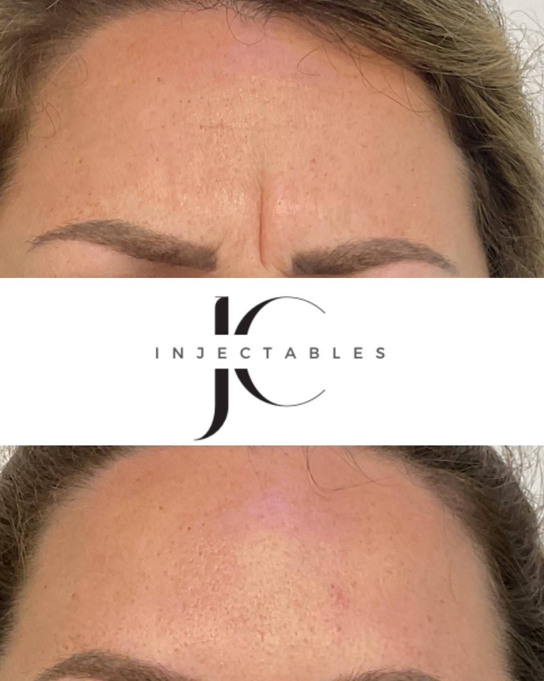 JC Injectables Before and After Image