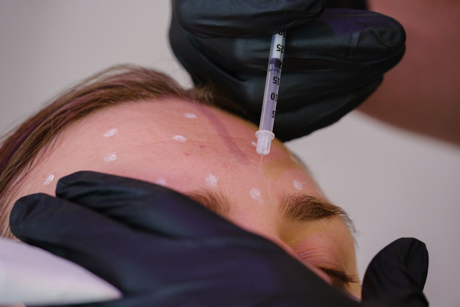 A woman is getting a botox injection in her forehead.