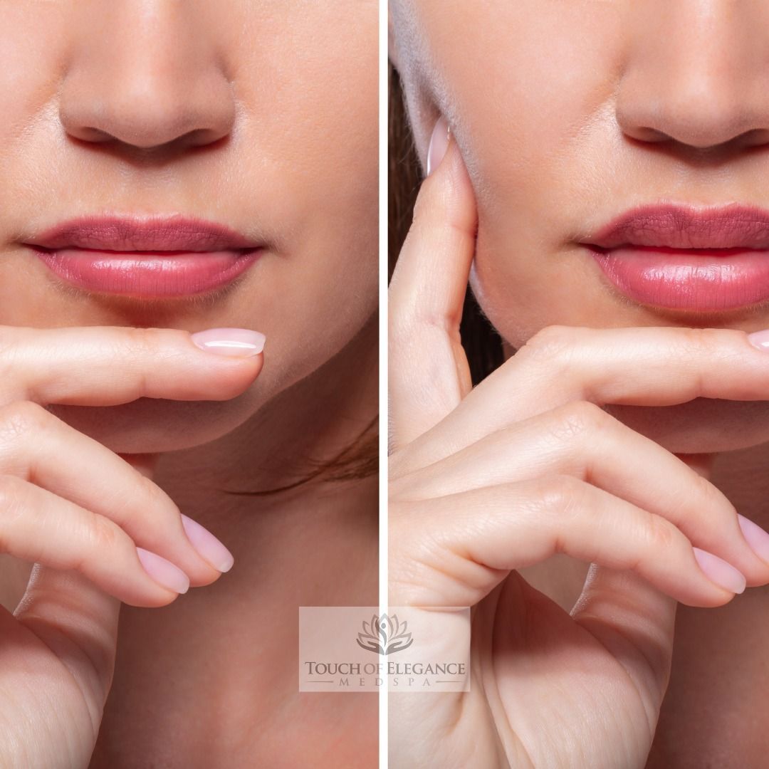 A before and after photo of a woman 's face