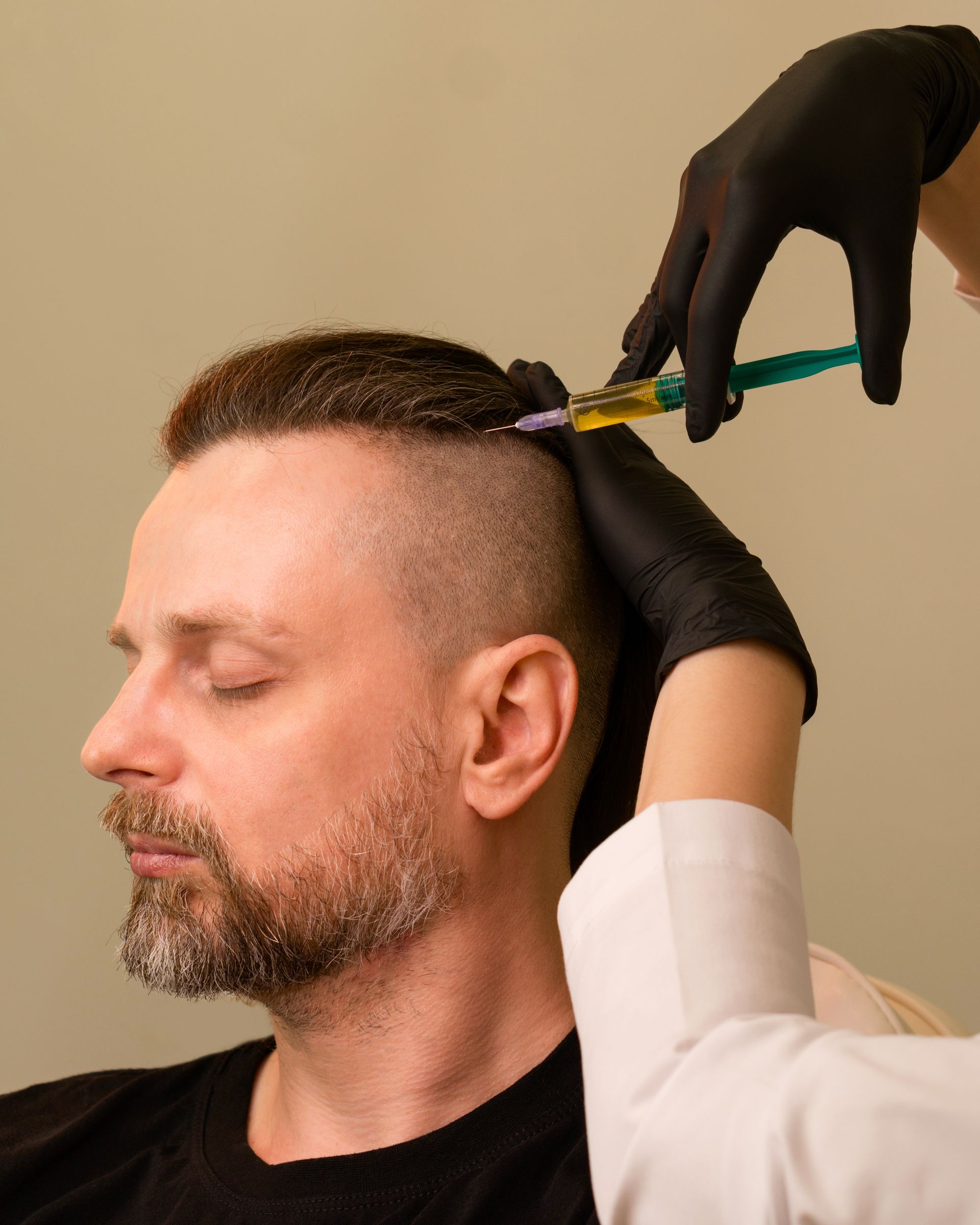 A man with a beard is getting an injection in his hair.