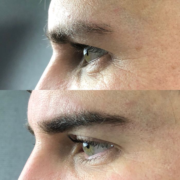 Brow Lamination