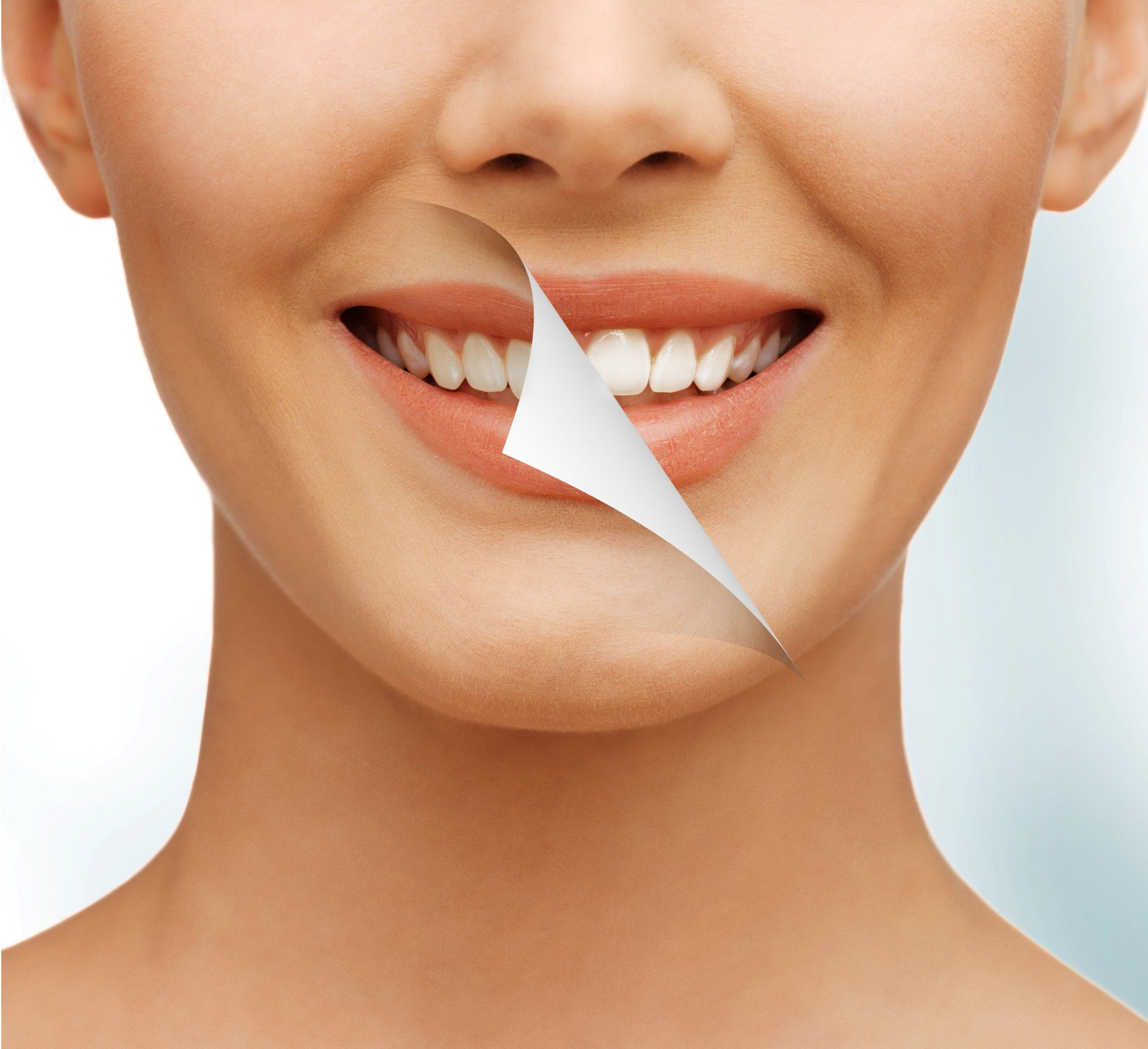Ellicott City Dentistry - Teeth Whitening