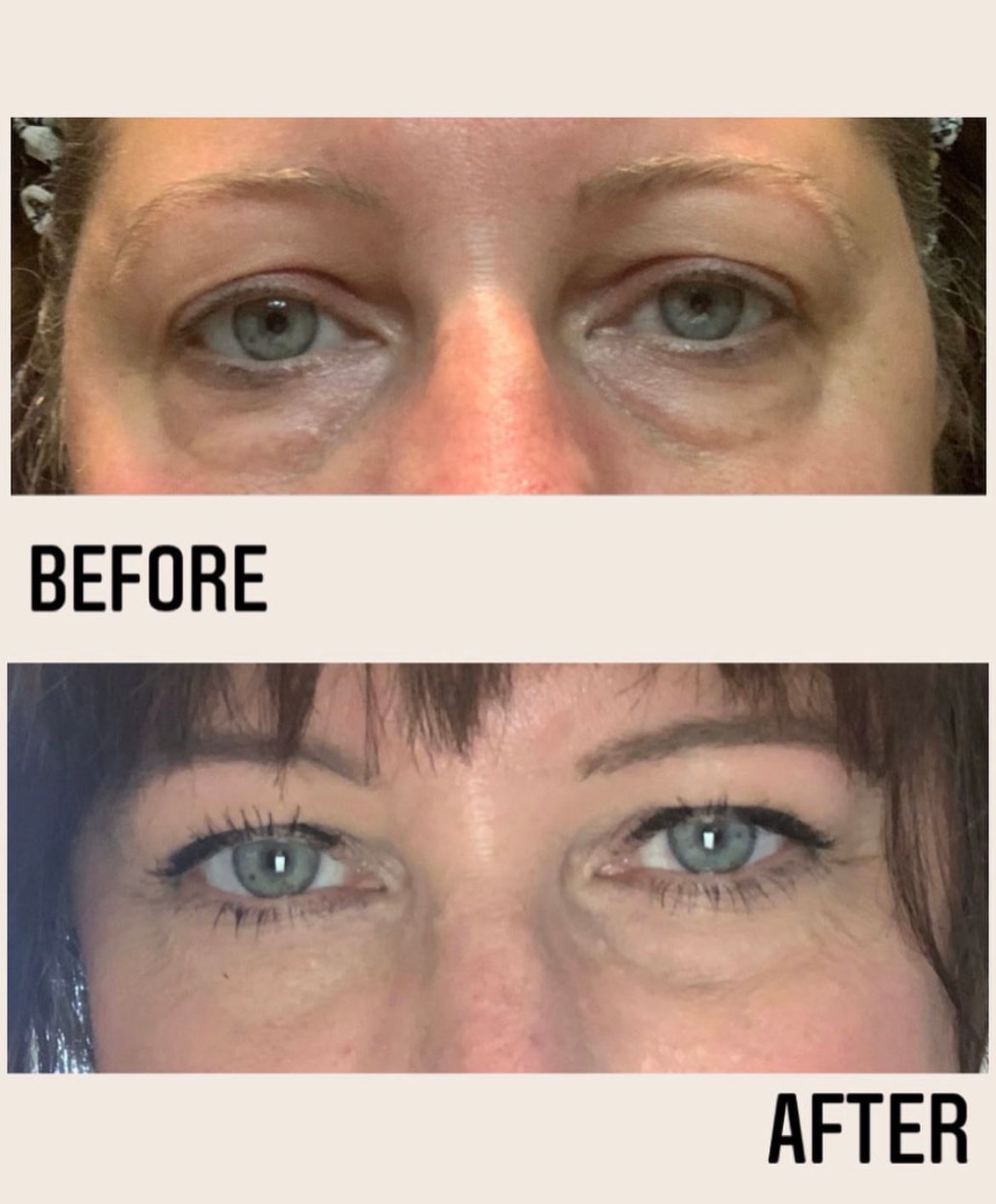 Tightening Services at Conway Med Spa