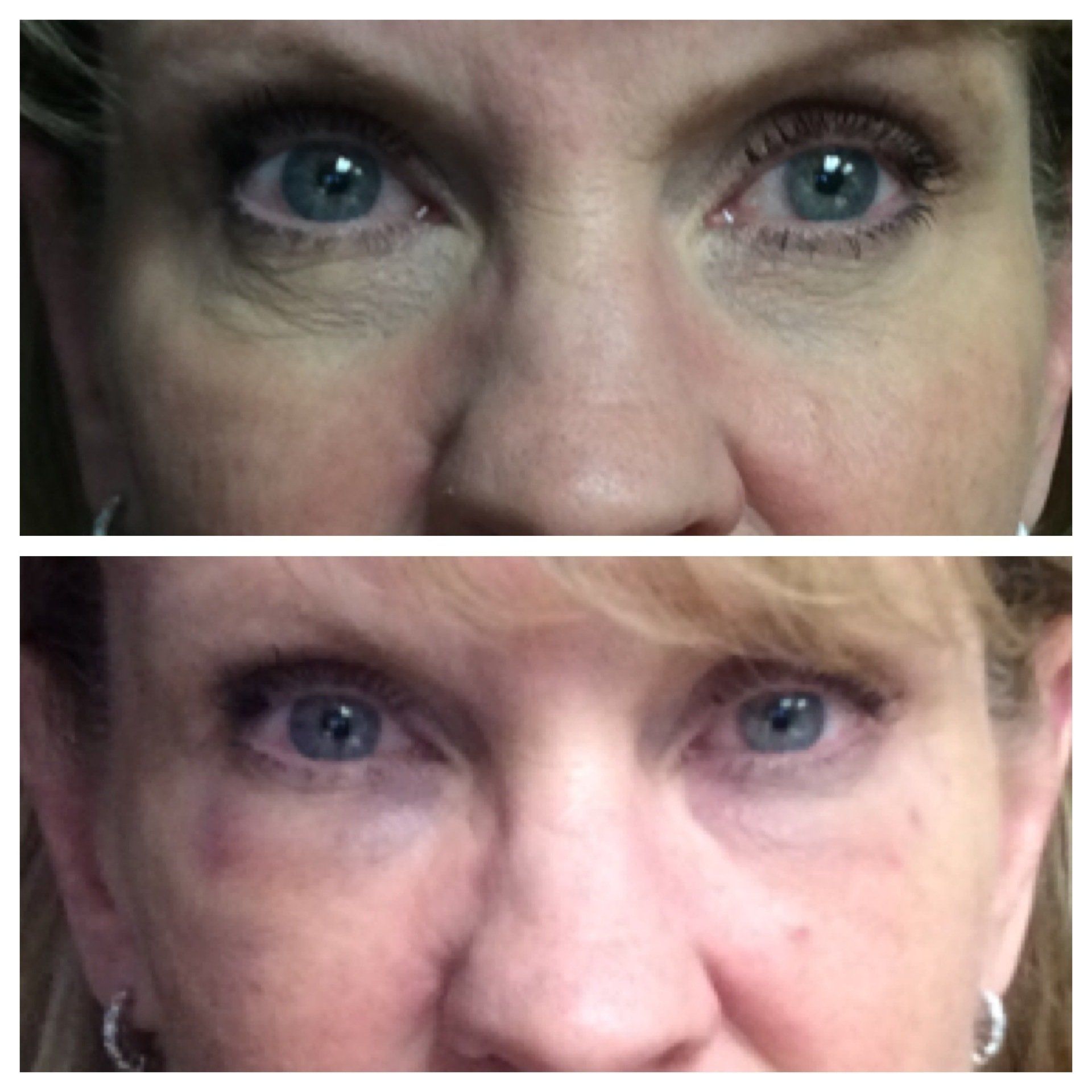 Before and After at Conway Med Spa