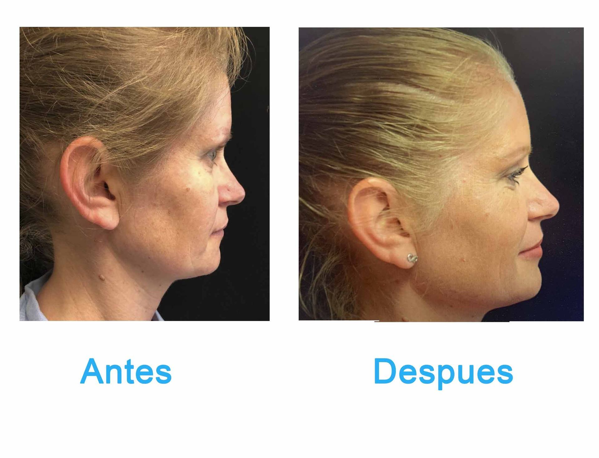 cirugia plastica en chihuahua