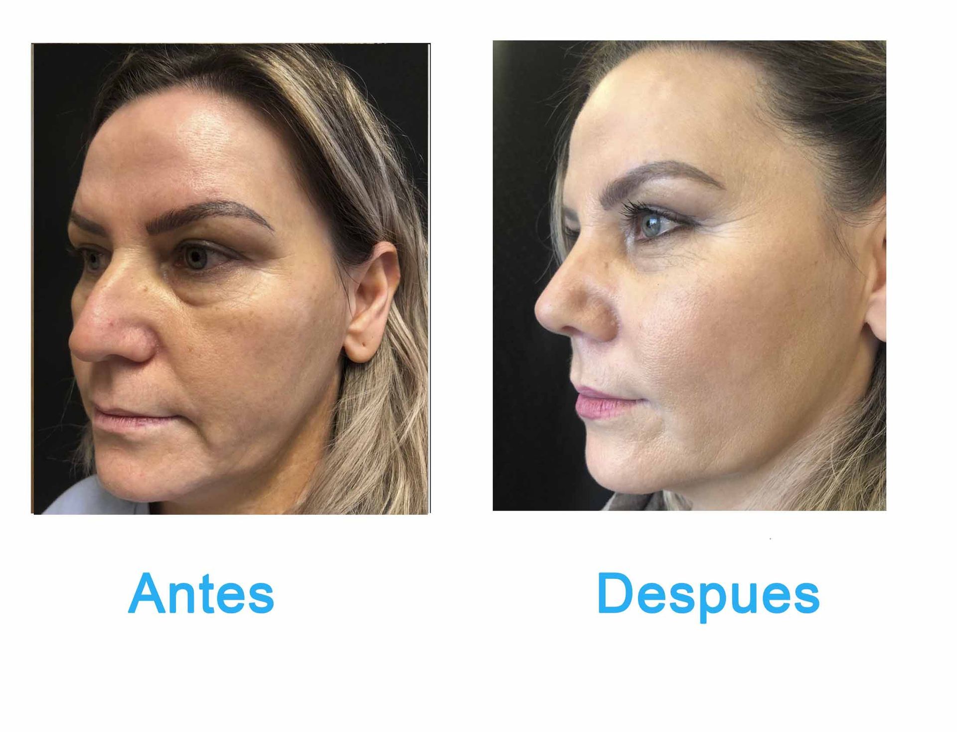 cirugia plastica en chihuahua