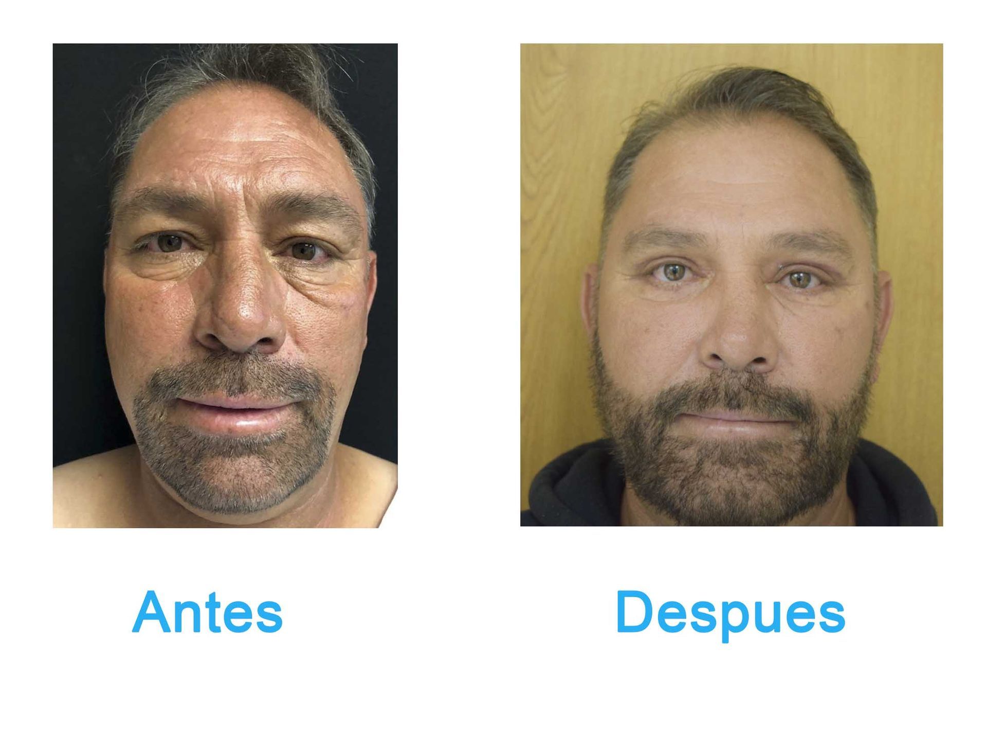 cirugia plastica en chihuahua