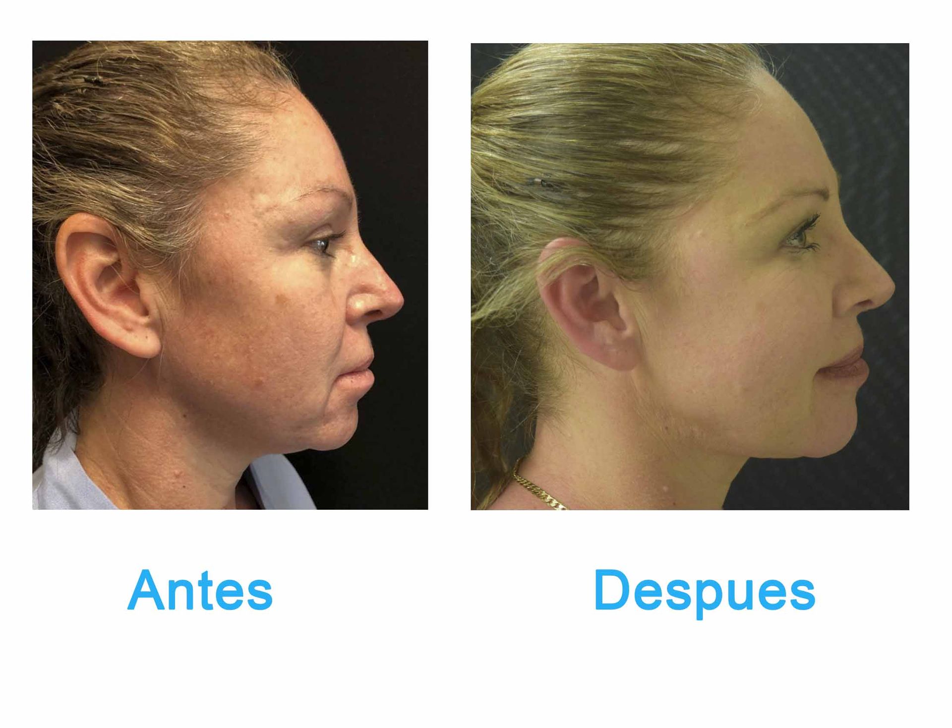 cirugia plastica en chihuahua