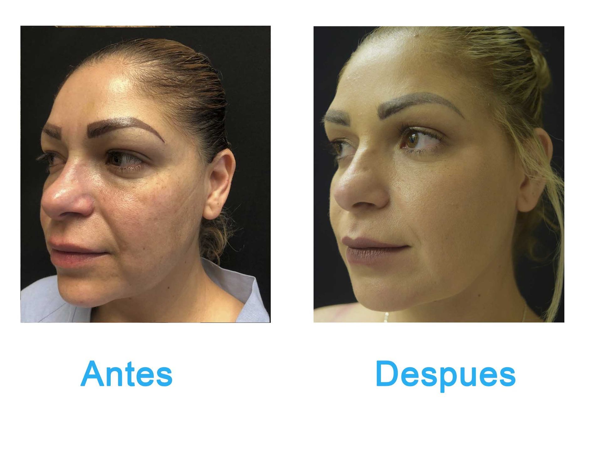 cirugia plastica en chihuahua