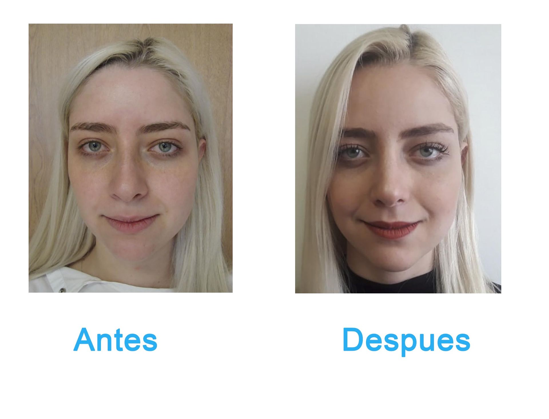 cirugia plastica en chihuahua