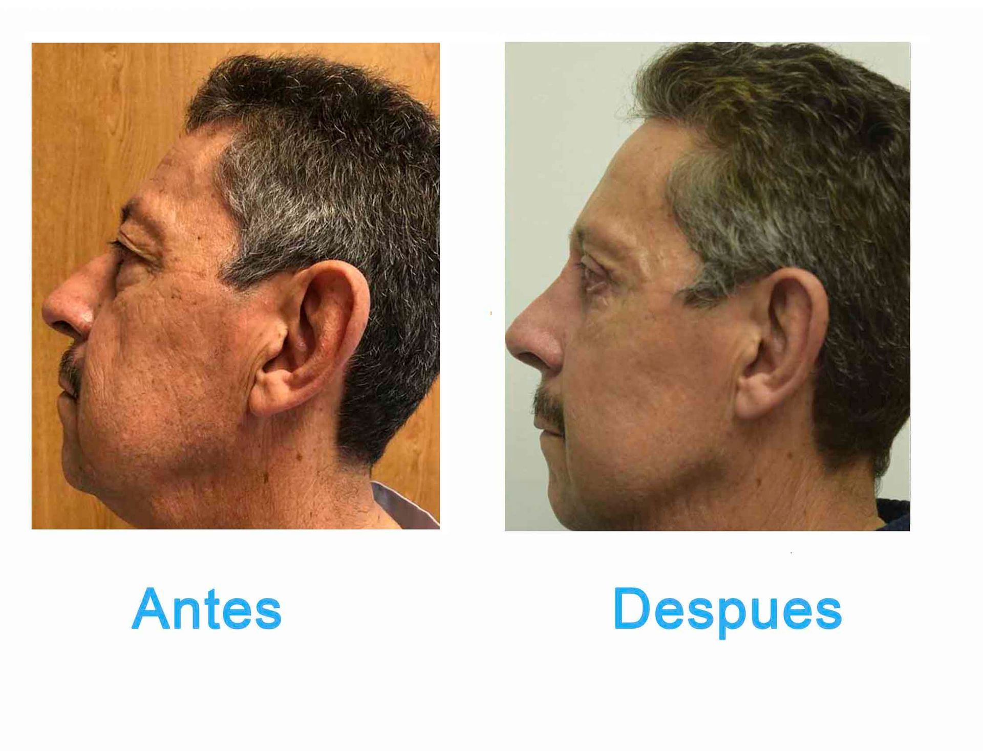 cirugia plastica en chihuahua