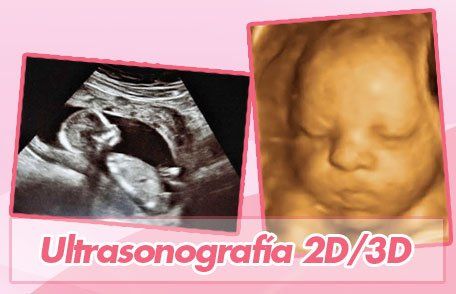 ultrasonografia