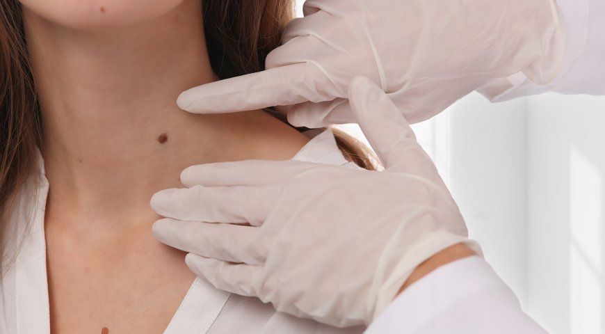 Um médico está examinando o pescoço de uma mulher em busca de uma pinta.