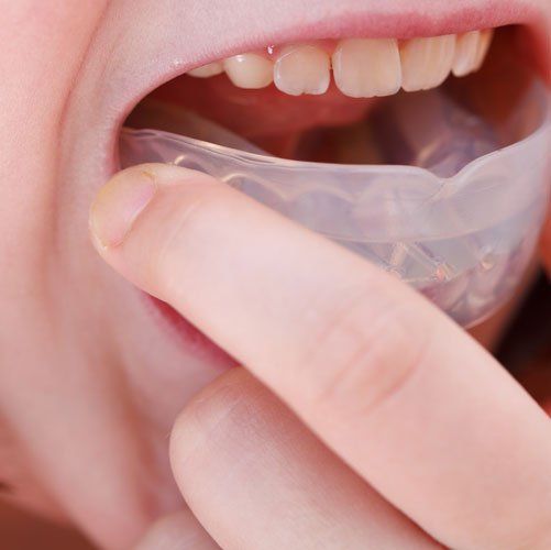 A person placing a mouth guard into their mouth