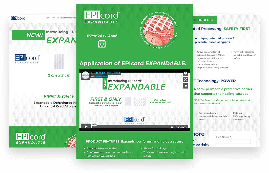 Web pages in table mode for EPIcord Expandable product. Green and white, with a video on the middle flyer.