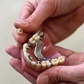 Dentures - Teeth whitening in Farmingdale, NY