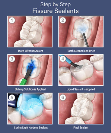 A woman having her teeth cleaned by her dentist