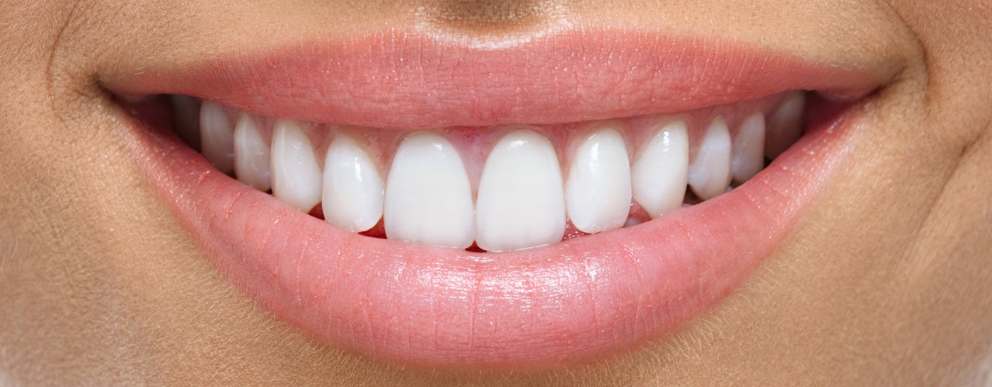 Beautiful clean teeth, a perfect example of good dental hygiene
