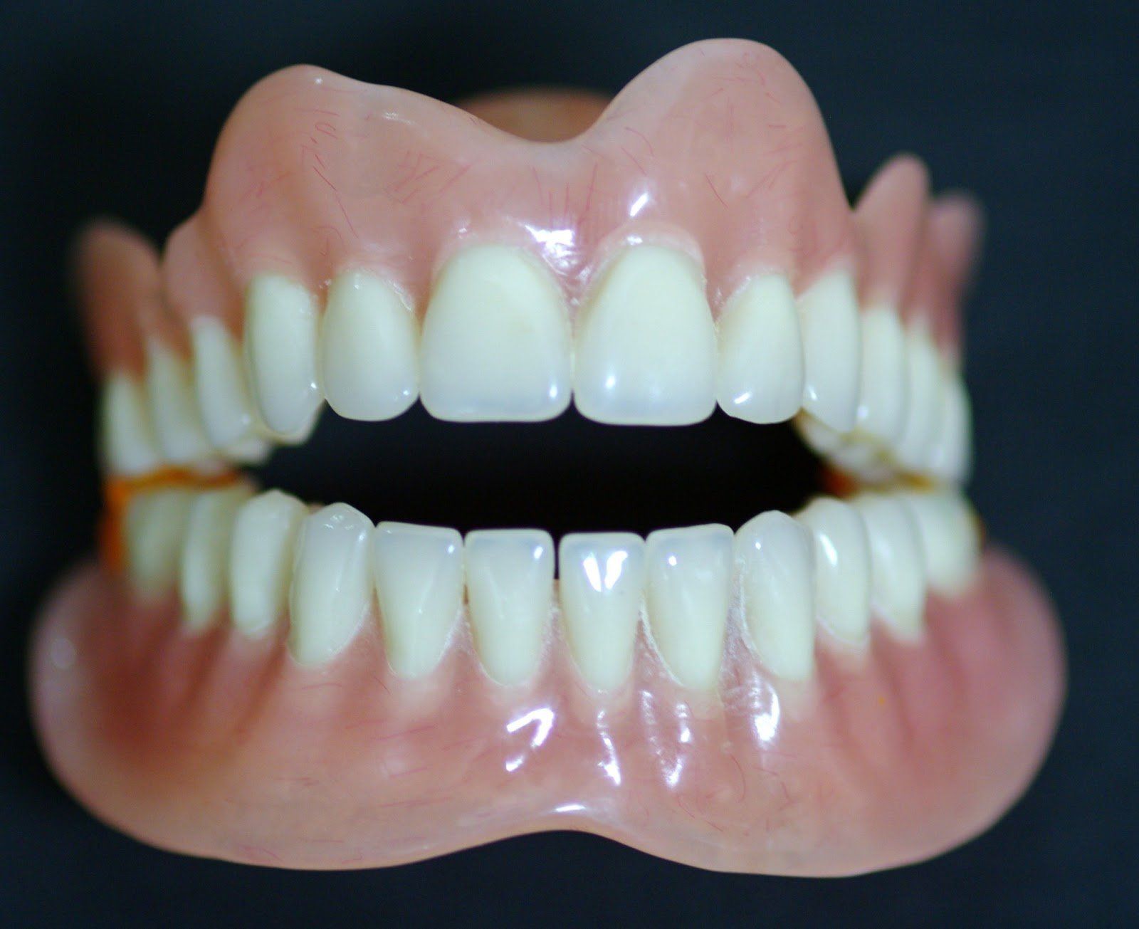 Denture, restorative dentistry