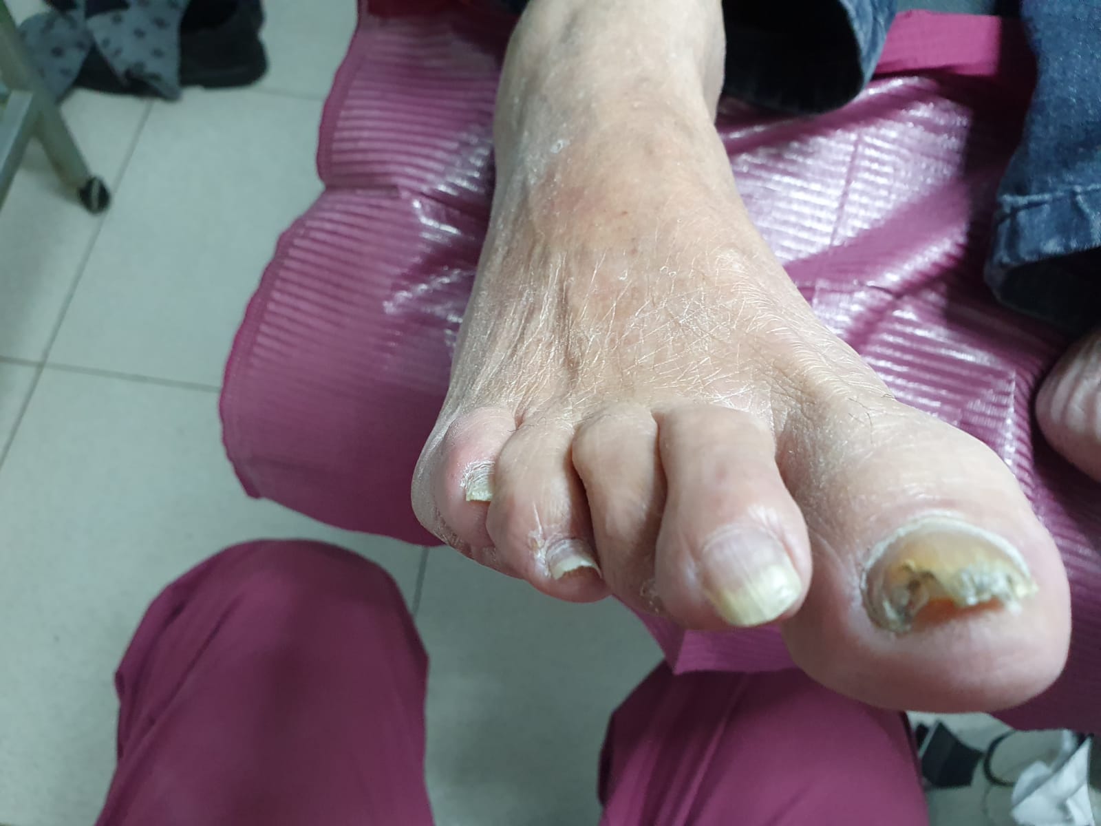 Silvia Verónica Quintero, Podóloga en Mar del Plata