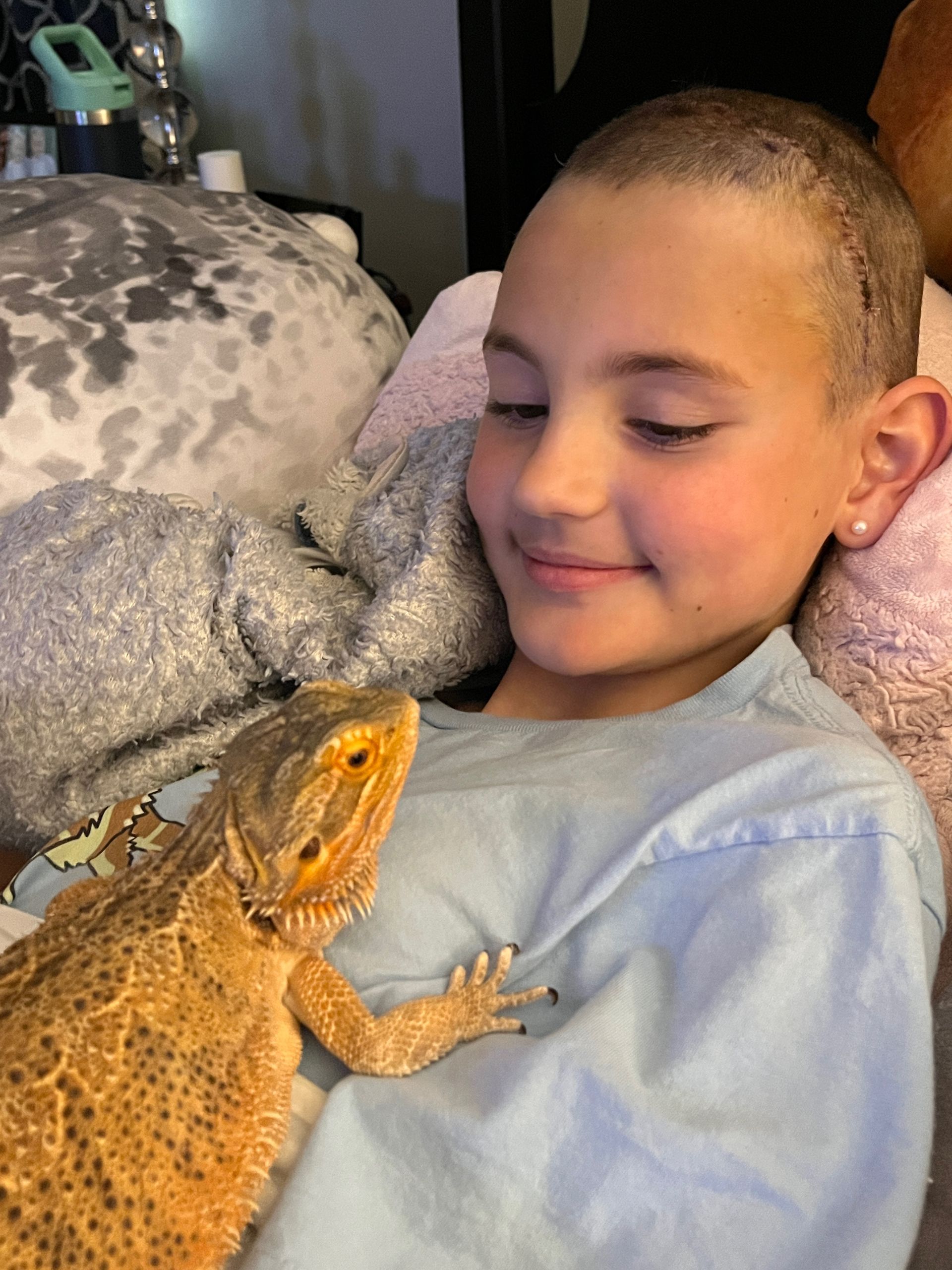 Charli Carr in hospital bed with iguana