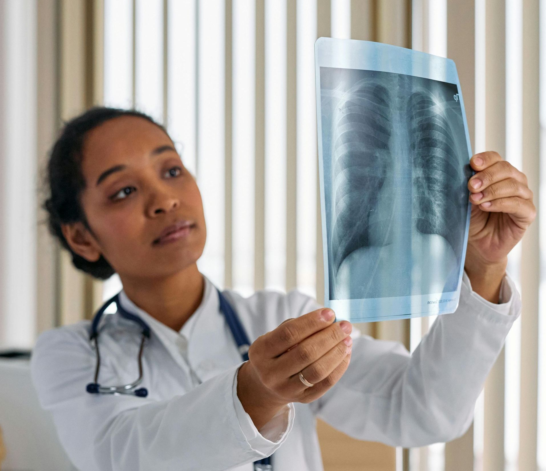 A doctor is holding an x-ray of lungs.