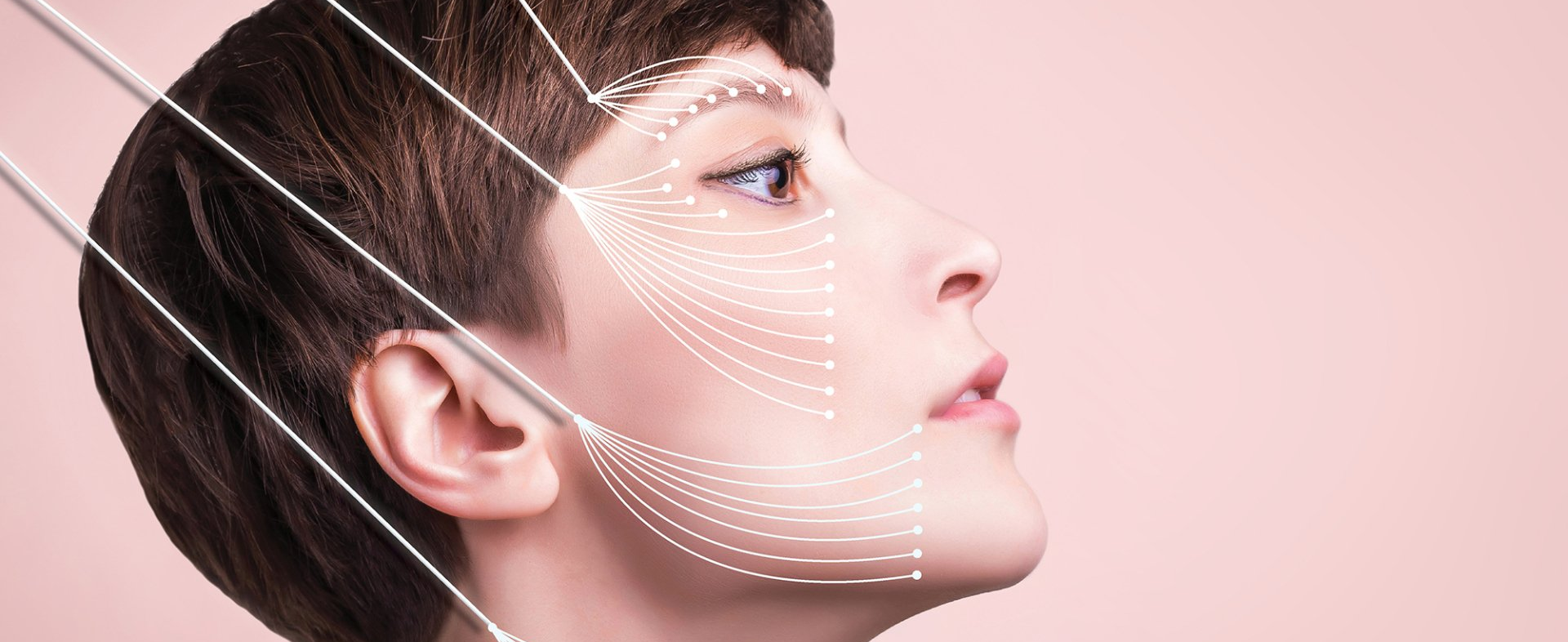 A close up of a woman 's face with lines drawn on it showcasing thread-lifts dermatology procedure